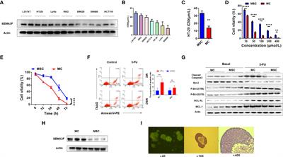 Semaphorin 3F induces colorectal cancer cell chemosensitivity by promoting P27 nuclear export